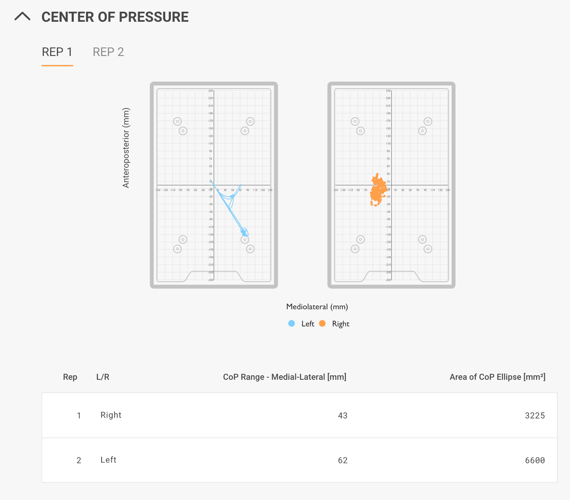 Center of Pressure test showing a stable right leg and wobbly left leg during a single-leg stand, revealing a greater than 25% asymmetry